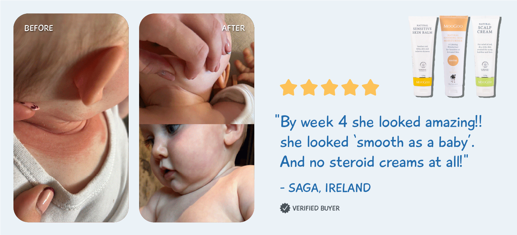 sensitive-moogoo-ireland